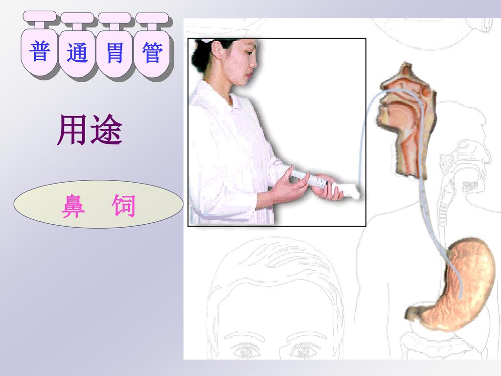 3                 是将胃管自鼻腔或口腔经食管